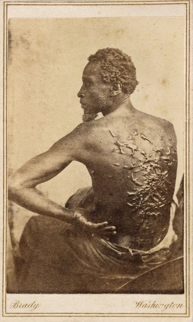 Gordon, a slave whose photos documenting the extreme brutality he survived were popularized in Harper's Weekly.